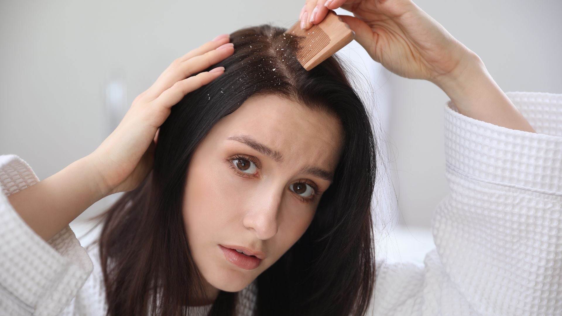 The Main Causes of Dandruff, And How to Treat Them